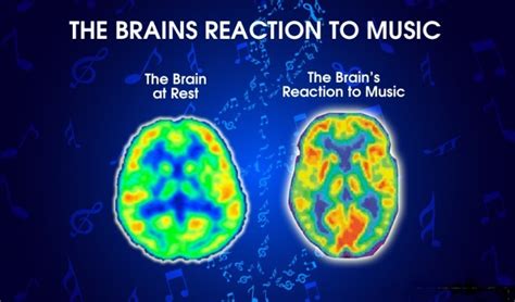 how bad is your streaming music? do you know what it does to your brain?